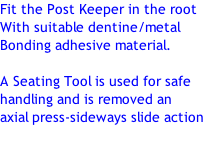Fit the Post Keeper in the root With suitable dentine/metal Bonding adhesive material.  A Seating Tool is used for safe  handling and is removed an  axial press-sideways slide action